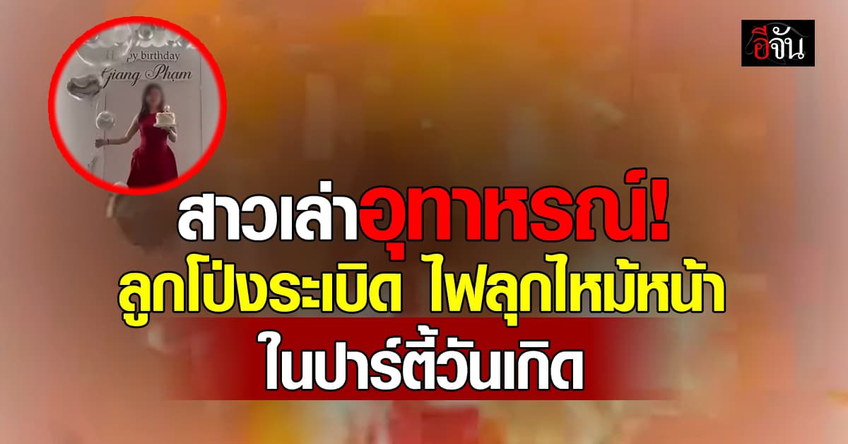 สาวเล่าอุทาหรณ์! ลูกโป่งระเบิด ไฟลุกไหม้ใบหน้า ในปาร์ตี้วันเกิด