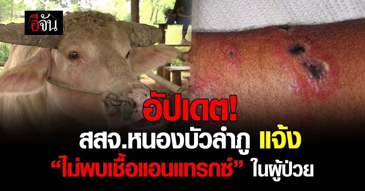 อัปเดต! หลัง สสจ.ได้รับแจ้งพบผู้ป่วยสงสัยโรคแอนแทรกซ์