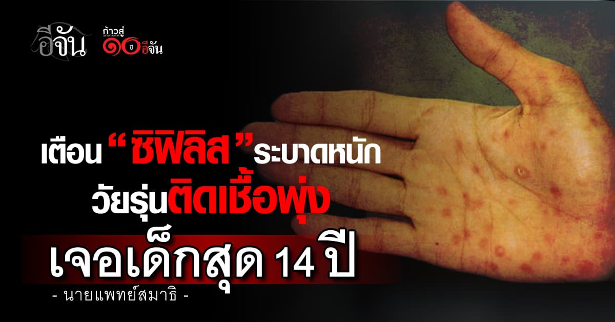 แพทย์เตือน “ซิฟิลิส” ระบาดหนัก ยอดวัยรุ่นติดเชื้อพุ่ง เด็กสุดแค่ 14 ปี