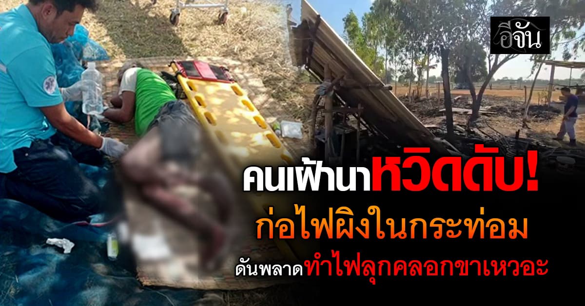 คนเฝ้านาหวิดดับ หลังก่อไฟผิงในกระท่อม ทำไฟลุกคลอกขาสาหัส
